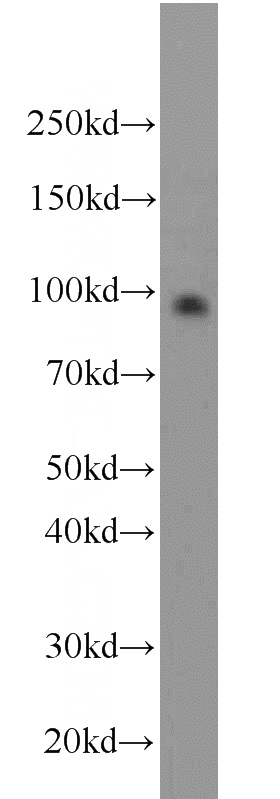 PC-3 cells were subjected to SDS PAGE followed by western blot with Catalog No:114735(RNF10 antibody) at dilution of 1:1000