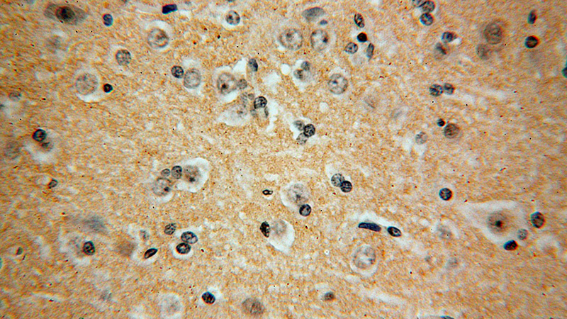 Immunohistochemical of paraffin-embedded human brain using Catalog No:114206(PRMT3 antibody) at dilution of 1:100 (under 40x lens)