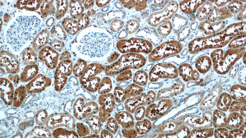Immunohistochemistry of paraffin-embedded human kidney tissue slide using Catalog No:107170(COTL1 Antibody) at dilution of 1:50