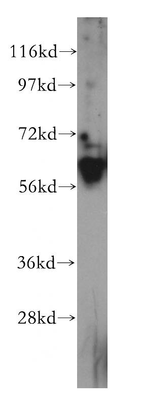 HeLa cells were subjected to SDS PAGE followed by western blot with Catalog No:108871(CASP10 antibody) at dilution of 1:300