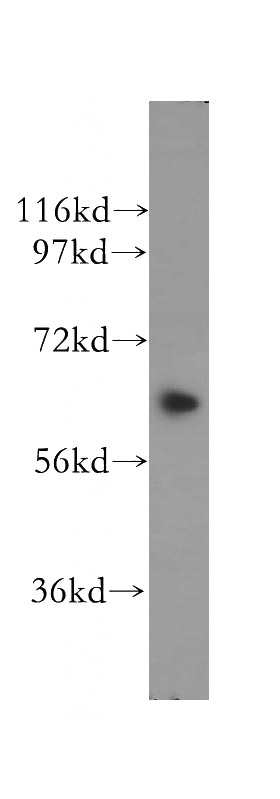 Y79 cells were subjected to SDS PAGE followed by western blot with Catalog No:111999(KIF12 antibody) at dilution of 1:400