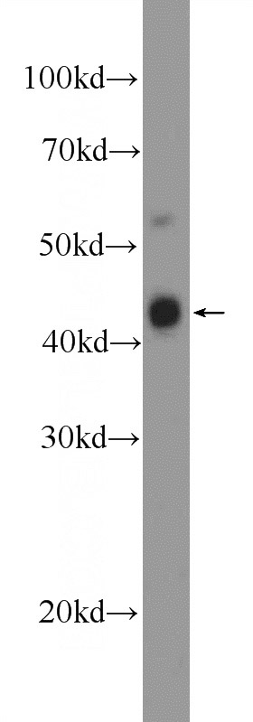 mouse thymus tissue were subjected to SDS PAGE followed by western blot with Catalog No:115906(TCF7 Antibody) at dilution of 1:600