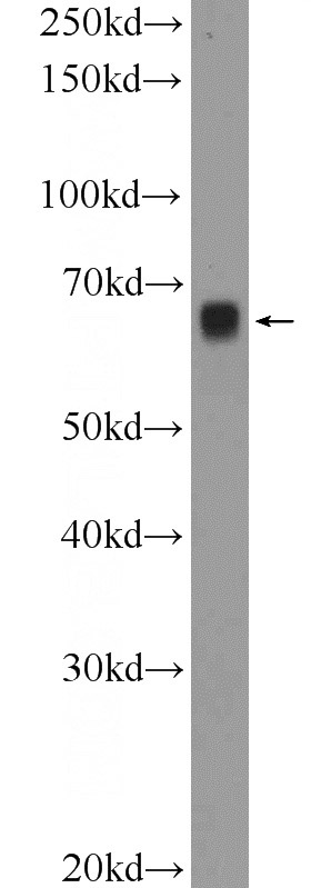 mouse brain tissue were subjected to SDS PAGE followed by western blot with Catalog No:110485(ETFDH Antibody) at dilution of 1:1000