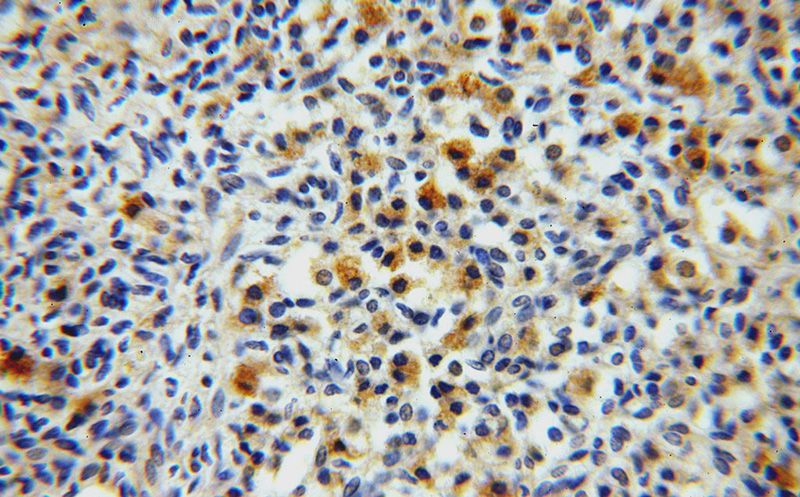 Immunohistochemical of paraffin-embedded human ovary using Catalog No:112253(KTN1 antibody) at dilution of 1:100 (under 40x lens)