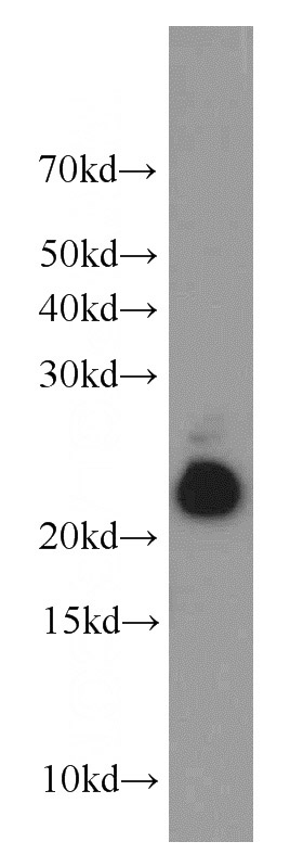 human brain tissue were subjected to SDS PAGE followed by western blot with Catalog No:113354(NUDT10 antibody) at dilution of 1:1000