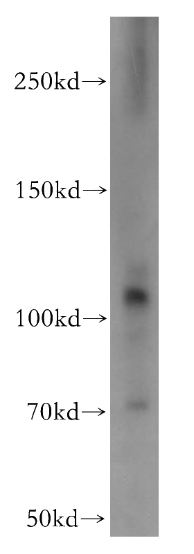 mouse skeletal muscle tissue were subjected to SDS PAGE followed by western blot with Catalog No:109048(PROM1 antibody) at dilution of 1:500