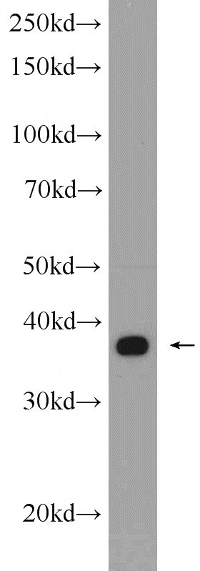 A549 cells were subjected to SDS PAGE followed by western blot with Catalog No:107847(AHSA1 Antibody) at dilution of 1:600