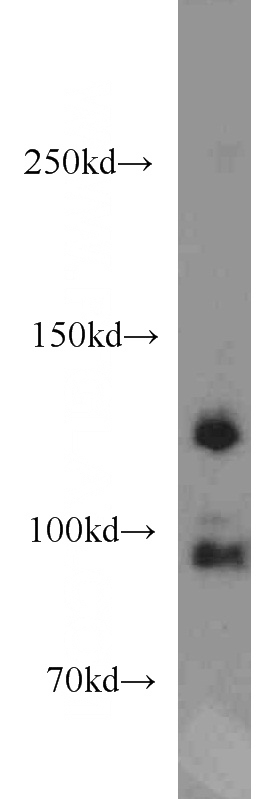 mouse kidney tissue were subjected to SDS PAGE followed by western blot with Catalog No:109816(CYTSB antibody) at dilution of 1:1000