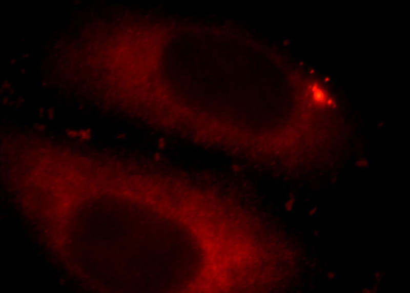 Immunofluorescent analysis of HepG2 cells, using CRYBB3 antibody Catalog No:109585 at 1:25 dilution and Rhodamine-labeled goat anti-rabbit IgG (red).