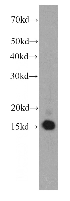HeLa cells were subjected to SDS PAGE followed by western blot with Catalog No:107599(SNRPD2 antibody) at dilution of 1:1000