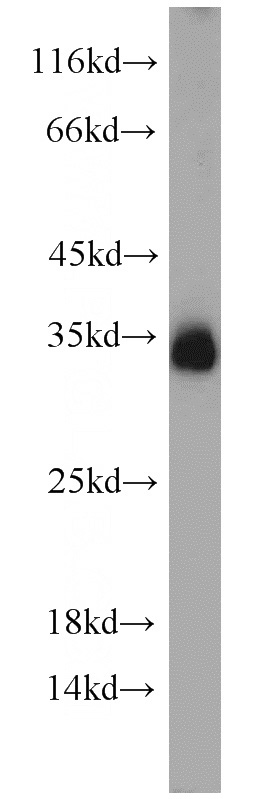 mouse brain tissue were subjected to SDS PAGE followed by western blot with Catalog No:115799(STX6 antibody) at dilution of 1:2000