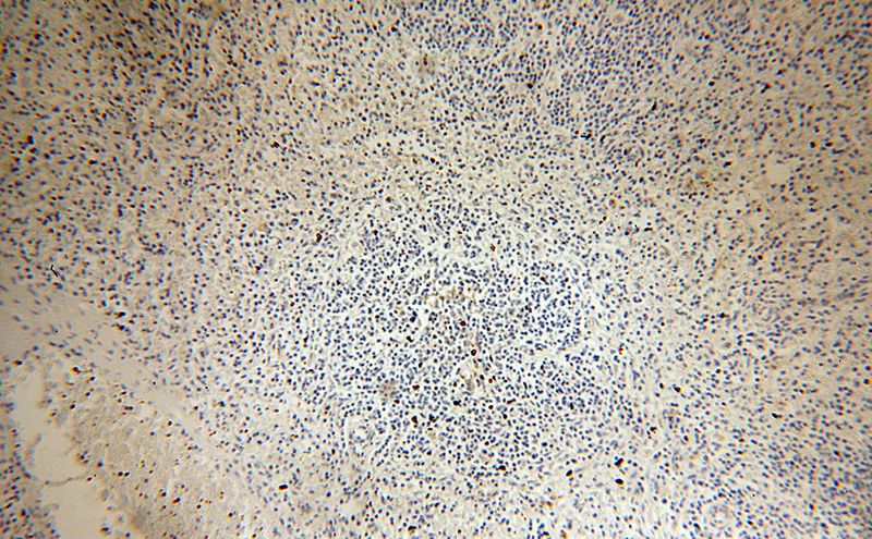 Immunohistochemical of paraffin-embedded human spleen using Catalog No:109141(CD82 antibody) at dilution of 1:50 (under 10x lens)