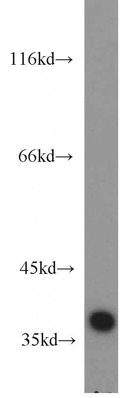 A549 cells were subjected to SDS PAGE followed by western blot with Catalog No:114142(PPP1CB antibody) at dilution of 1:2000