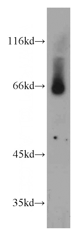 human placenta tissue were subjected to SDS PAGE followed by western blot with Catalog No:115319(SLC24A6 antibody) at dilution of 1:300