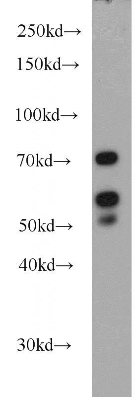 HeLa cells were subjected to SDS PAGE followed by western blot with Catalog No:112407(LYN antibody) at dilution of 1:1000