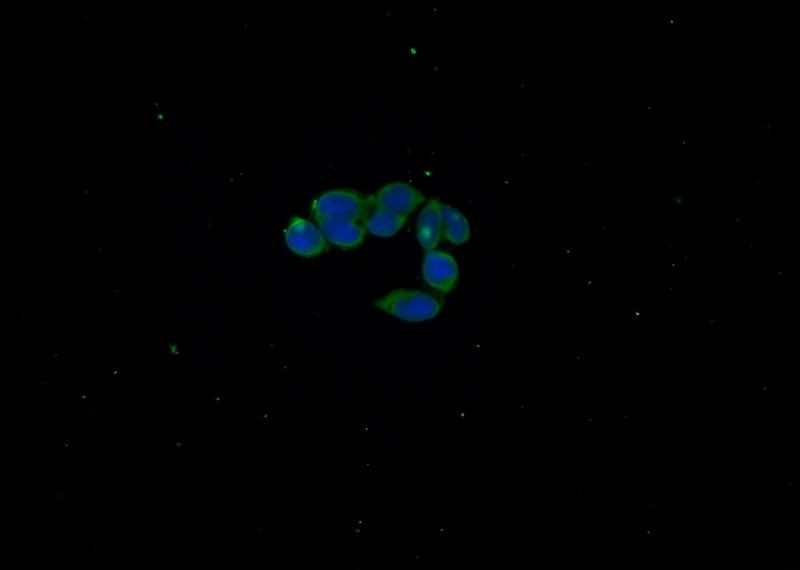 Immunofluorescent analysis of HEK-293 cells using Catalog No:108707(C21orf59 Antibody) at dilution of 1:50 and Alexa Fluor 488-congugated AffiniPure Goat Anti-Rabbit IgG(H+L)