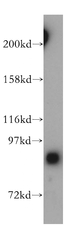 HeLa cells were subjected to SDS PAGE followed by western blot with Catalog No:111154(ARHGAP26 antibody) at dilution of 1:1000
