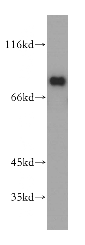 K-562 cells were subjected to SDS PAGE followed by western blot with Catalog No:110259(EIF4B antibody) at dilution of 1:300