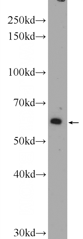 mouse brain tissue were subjected to SDS PAGE followed by western blot with Catalog No:115876(TBL1XR1 Antibody) at dilution of 1:300