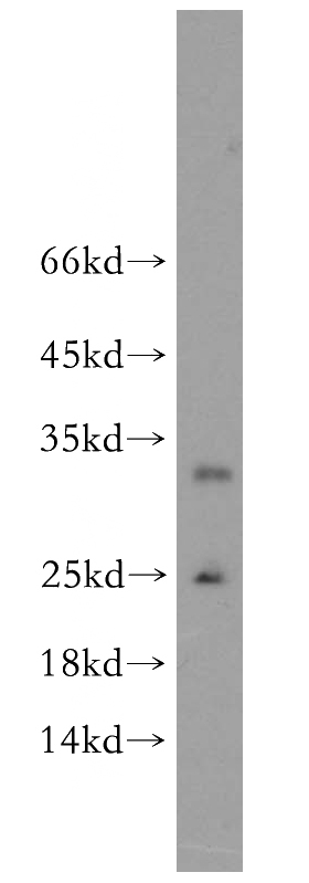 human testis tissue were subjected to SDS PAGE followed by western blot with Catalog No:111150(GPX5 antibody) at dilution of 1:200