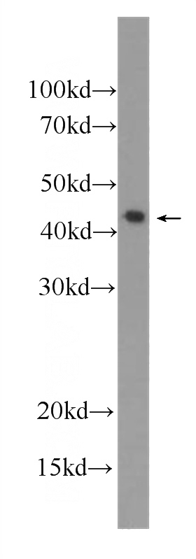 Recombinant protein were subjected to SDS PAGE followed by western blot with Catalog No:107388(IL1F8 Antibody) at dilution of 1:8000
