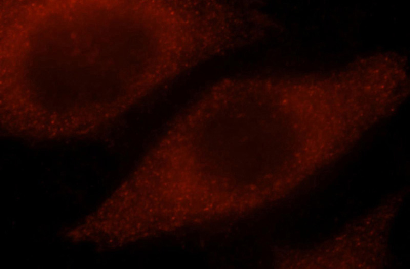 Immunofluorescent analysis of MCF-7 cells, using NPL antibody Catalog No:113217 at 1:25 dilution and Rhodamine-labeled goat anti-rabbit IgG (red).