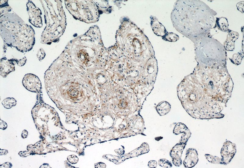 Immunohistochemistry of paraffin-embedded human placenta tissue slide using Catalog No:111922(KCNA10 Antibody) at dilution of 1:50 (under 10x lens)