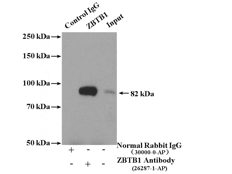 IP Result of anti-ZBTB1 (IP:Catalog No:116907, 4ug; Detection:Catalog No:116907 1:300) with HeLa cells lysate 4000ug.