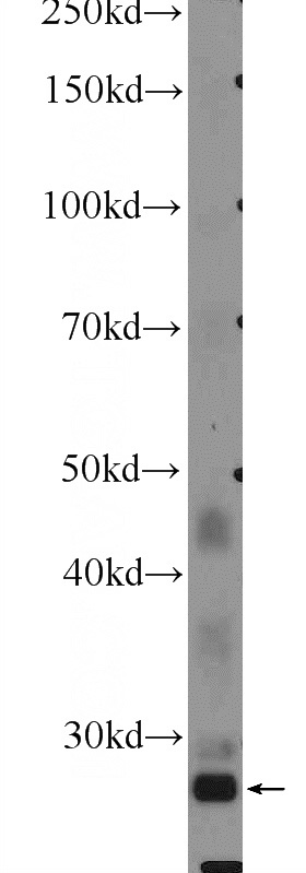 HepG2 cells were subjected to SDS PAGE followed by western blot with Catalog No:110547(FBXO17 Antibody) at dilution of 1:300