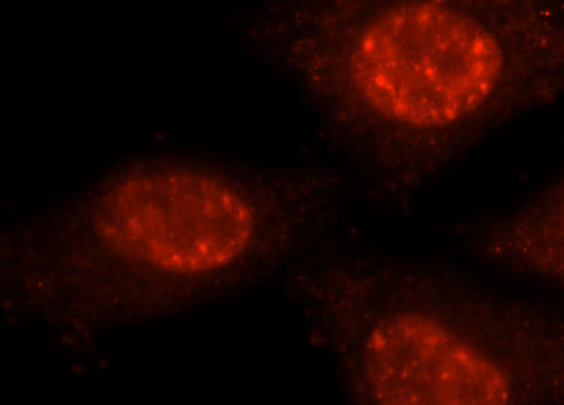 Immunofluorescent analysis of HepG2 cells, using PRPF40B antibody Catalog No:114233 at 1:25 dilution and Rhodamine-labeled goat anti-rabbit IgG (red).