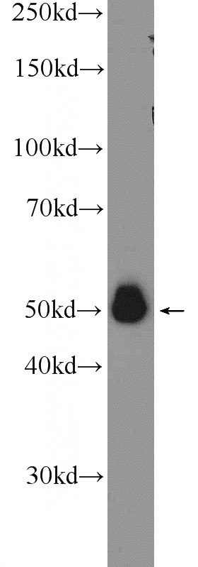 RAW 264.7 cells were subjected to SDS PAGE followed by western blot with Catalog No:107667(A4GALT Antibody) at dilution of 1:1000