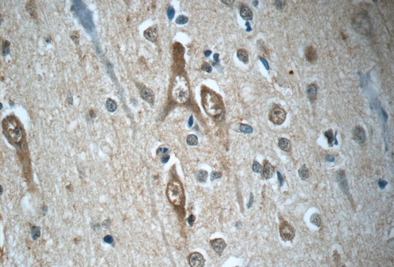Immunohistochemistry of paraffin-embedded human brain tissue slide using Catalog No:115504(SORCS1 Antibody) at dilution of 1:50 (under 40x lens)