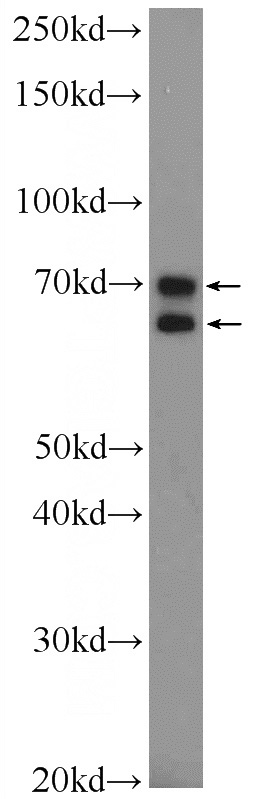 COLO 320 cells were subjected to SDS PAGE followed by western blot with Catalog No:108980(CCDC55 Antibody) at dilution of 1:600