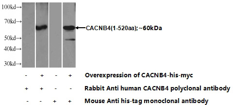 Transfected HEK-293 cells were subjected to SDS PAGE followed by western blot with Catalog No:108764(CACNB4 Antibody) at dilution of 1:1000
