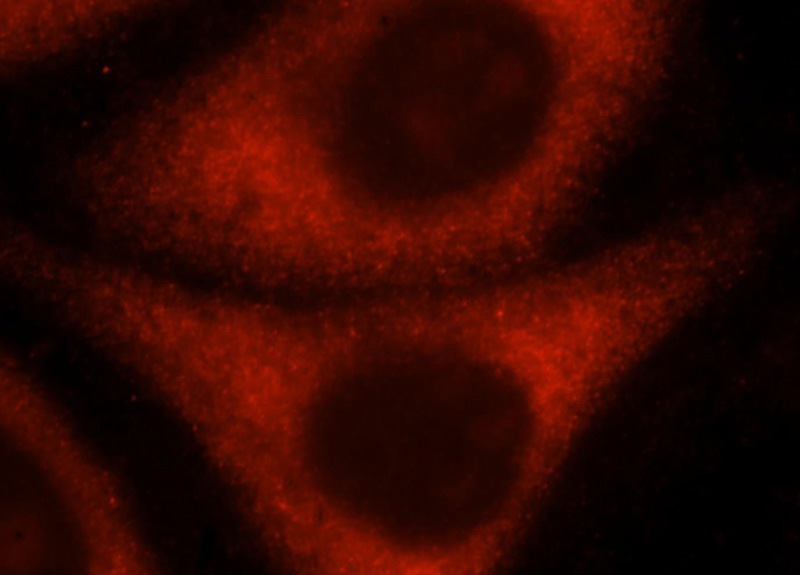 Immunofluorescent analysis of HepG2 cells, using RPL10A antibody Catalog No:114810 at 1:25 dilution and Rhodamine-labeled goat anti-rabbit IgG (red).