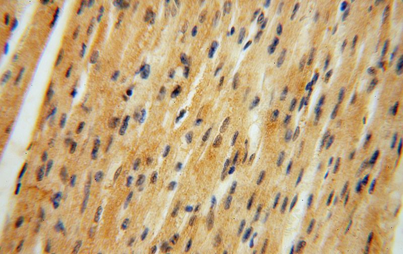 Immunohistochemical of paraffin-embedded human heart using Catalog No:113567(PAN2 antibody) at dilution of 1:50 (under 40x lens)