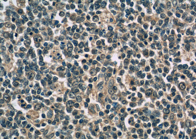 Immunohistochemistry of paraffin-embedded human tonsillitis tissue slide using Catalog No:107404(IL9 Antibody) at dilution of 1:50 (under 40x lens)