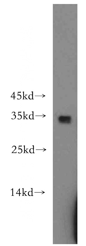 Raji cells were subjected to SDS PAGE followed by western blot with Catalog No:114353(PYCR1 antibody) at dilution of 1:500
