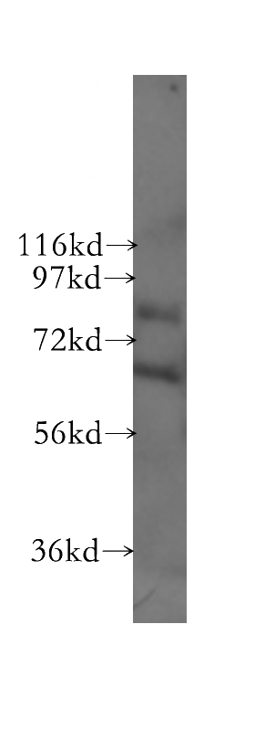 human brain tissue were subjected to SDS PAGE followed by western blot with Catalog No:115010(SCNN1A antibody) at dilution of 1:500