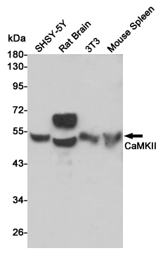 Western blot analysis of CaMKII expression in SHSY-5Y,Rat Brain,3T3 and Mouse Spleen cell lysates using CaMKII antibody at 1/1000 dilution.Predicted band size:45,60KDa.Observed band size:45,60KDa.