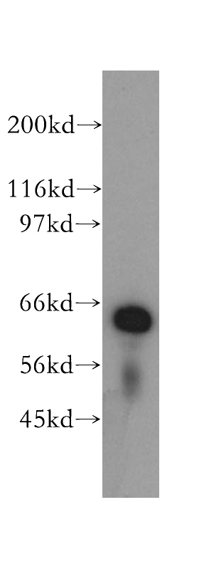 HeLa cells were subjected to SDS PAGE followed by western blot with Catalog No:112213(LGTN antibody) at dilution of 1:500
