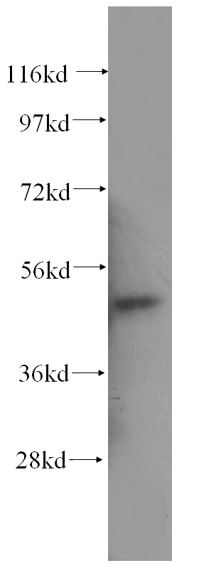 human bladder tissue were subjected to SDS PAGE followed by western blot with Catalog No:108288(ATG12 antibody) at dilution of 1:500