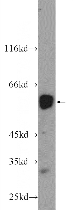 mouse thymus tissue were subjected to SDS PAGE followed by western blot with Catalog No:114936(RUNX1 Antibody) at dilution of 1:1000