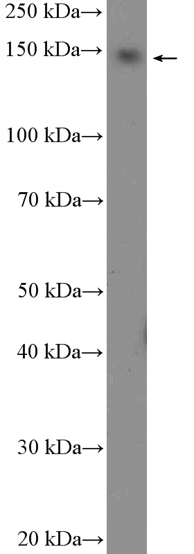Jurkat cells were subjected to SDS PAGE followed by western blot with Catalog No:117104(BCL9 Antibody) at dilution of 1:600