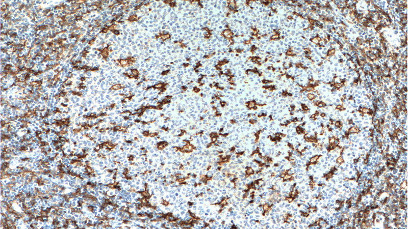 Immunohistochemistry of paraffin-embedded human tonsillitis tissue slide using Catalog No:107040(CD11c/Integrin alpha X Antibody) at dilution of 1:200 (under 10x lens). heat mediated antigen retrieved with Tris-EDTA buffer(pH9).