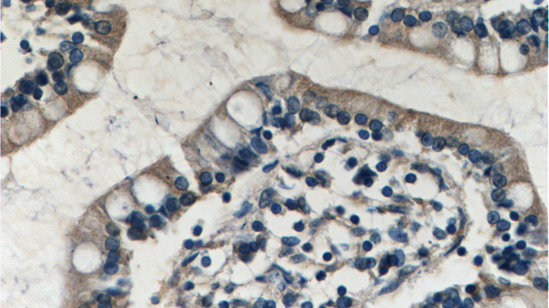 Immunohistochemistry of paraffin-embedded human small intestine tissue slide using Catalog No:114533(RAMP1 Antibody) at dilution of 1:200 (under 40x lens).