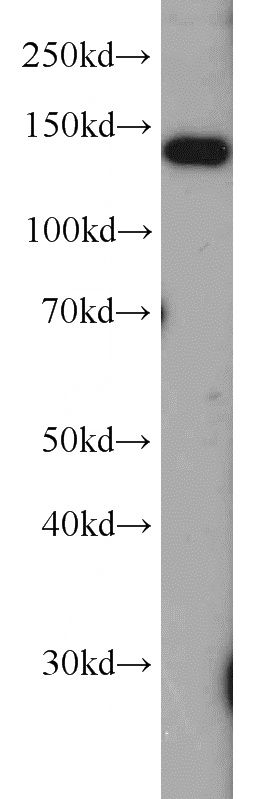 HepG2 cells were subjected to SDS PAGE followed by western blot with Catalog No:114467(RPTOR antibody) at dilution of 1:1000