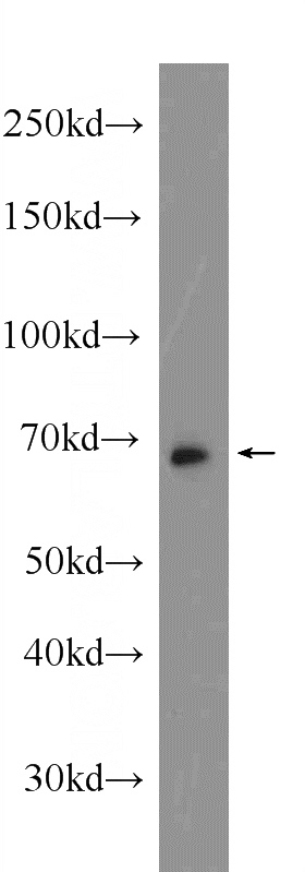 MDA-MB-453s cells were subjected to SDS PAGE followed by western blot with Catalog No:108068(ANKRD13C Antibody) at dilution of 1:600
