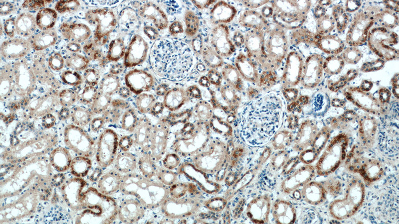 Immunohistochemical of paraffin-embedded human kidney using Catalog No:109214(CHCHD4 antibody) at dilution of 1:100 (under 10x lens)