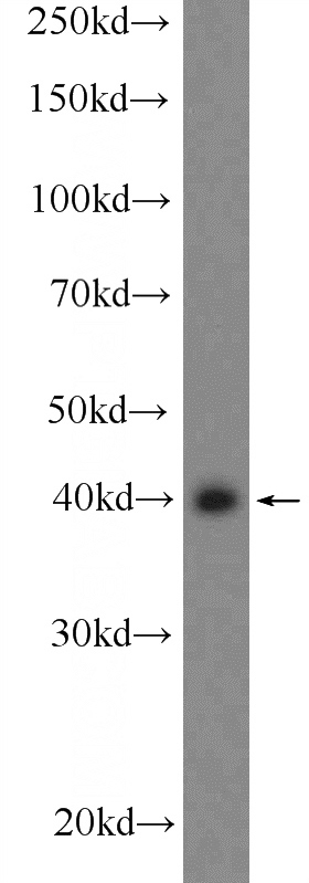 HUVEC cells were subjected to SDS PAGE followed by western blot with Catalog No:109385(CLEC4G Antibody) at dilution of 1:300
